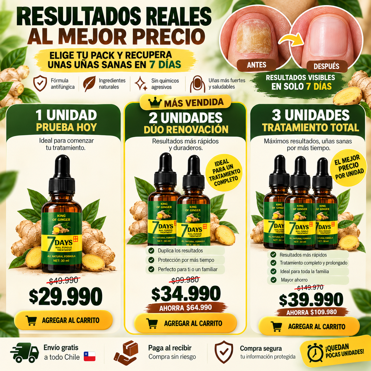 Aceite Anti-Hongos de Jengibre para Uñas | Fórmula 7 días