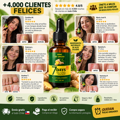 Aceite Anti-Hongos de Jengibre para Uñas | Fórmula 7 días