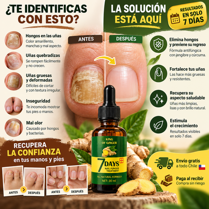 Aceite Anti-Hongos de Jengibre para Uñas | Fórmula 7 días