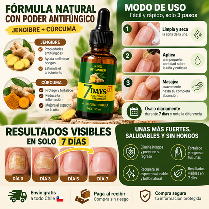 Aceite Anti-Hongos de Jengibre para Uñas | Fórmula 7 días